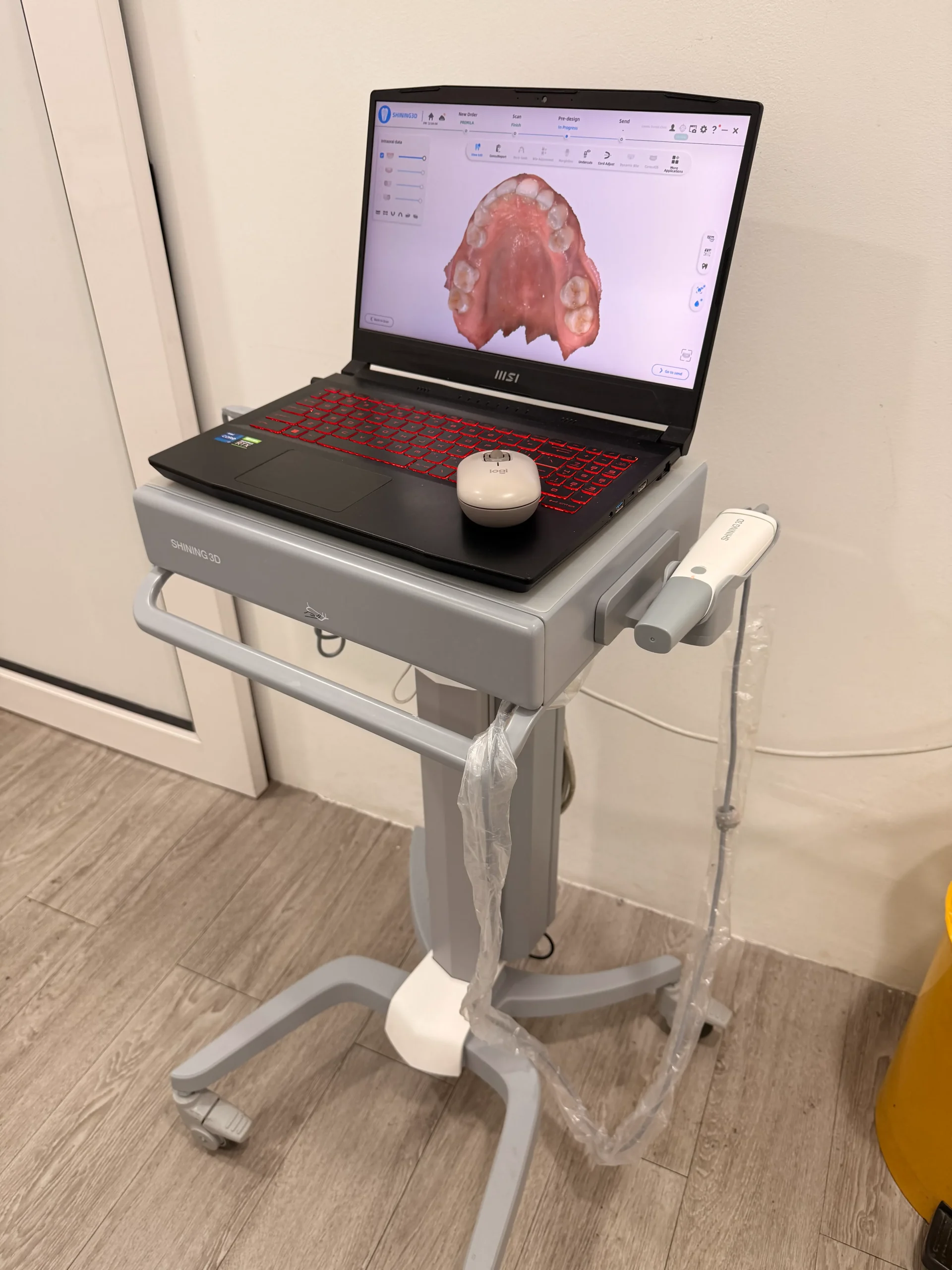 Intraoral digital scanner showing a 3D tooth scan